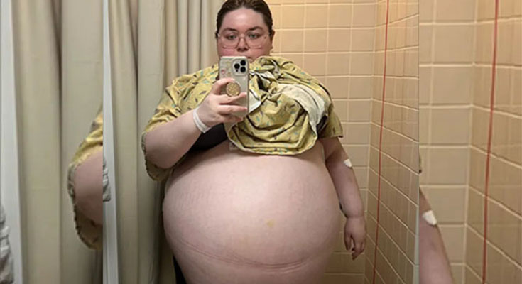 Doctors were astounded by what they saw when they examined her erupting belly as it continued to grow.