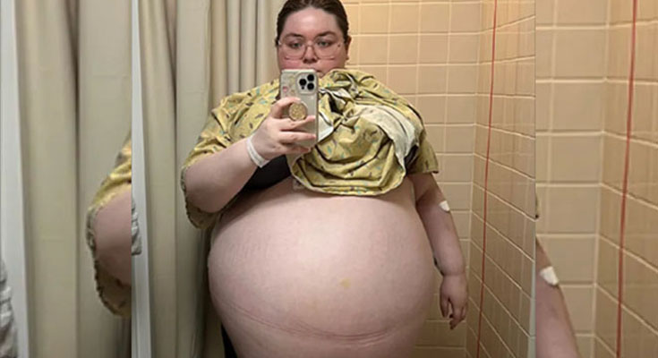 Doctors were astounded by what they saw when they examined her erupting belly as it continued to grow.