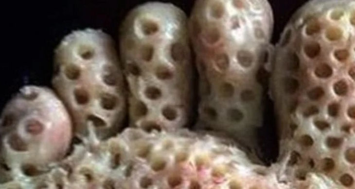 Trypophobia