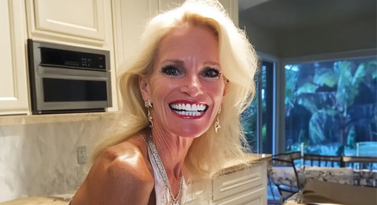 My Stepmom Stole $5,000 from My College Fund to Install Veneers for Herself — Karma Hit Her Hard