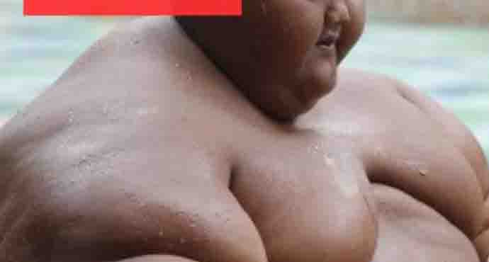 At Just 10 Years Old and Weighing 190 kg, The World’s Heaviest Boy Lost Weight and Here is How He Looks Now…