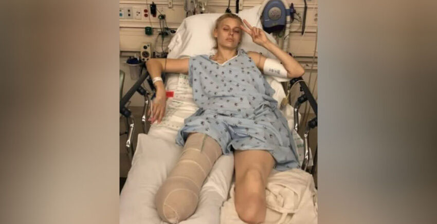 Her legs are amputated after using a common household product