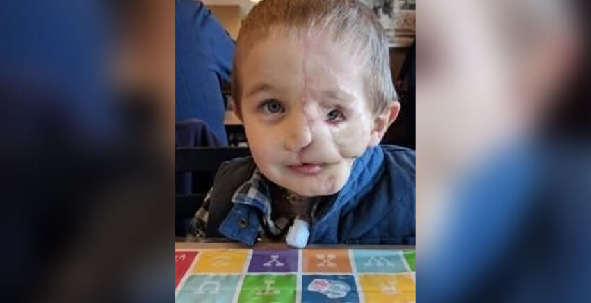 Boy, 5, survives savage attack by two dogs only to be called a ‘monster’ in public