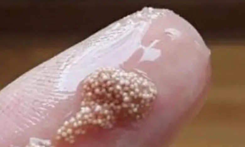 I found slimy lumps in an egg and thought they