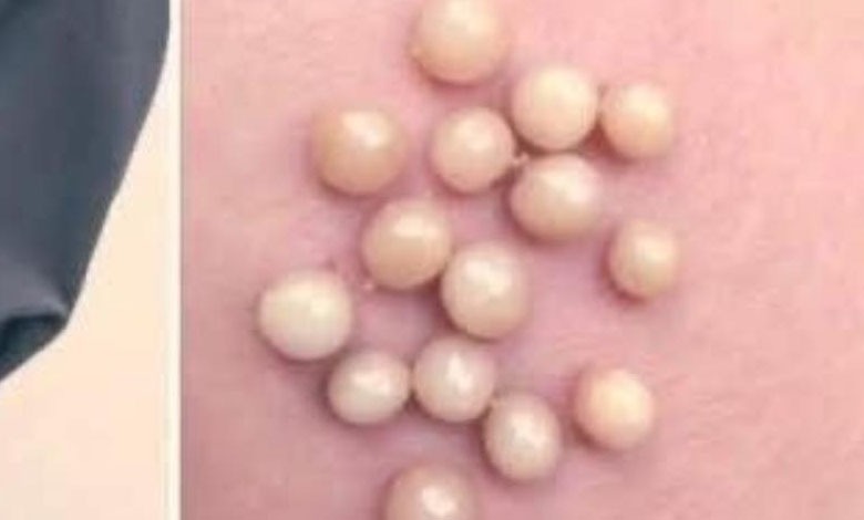 BE CAREFUL, if you notice this in your