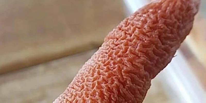 SHOCKING MEDICAL MYSTERY REVEALED AS SUDDEN PAINFUL LESIONS ON WOMANS FACE LEAD TO RARE DIAGNOSIS THAT STUNNED DOCTORS